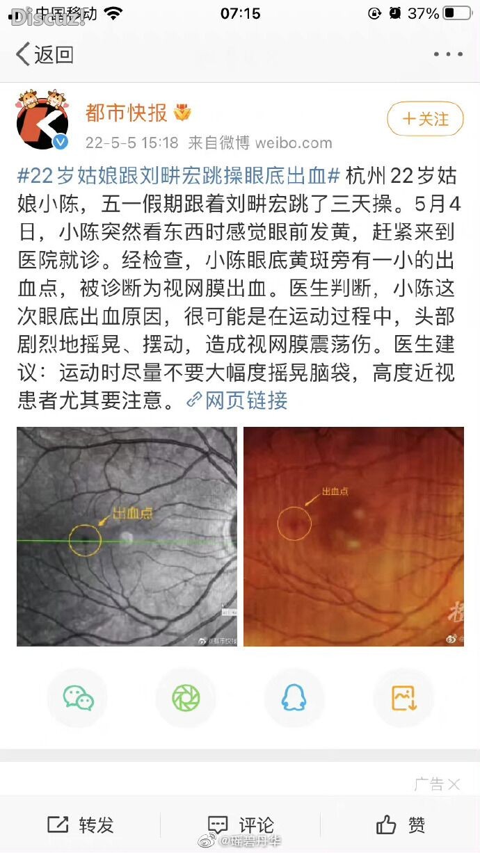 眼底震动.jpg